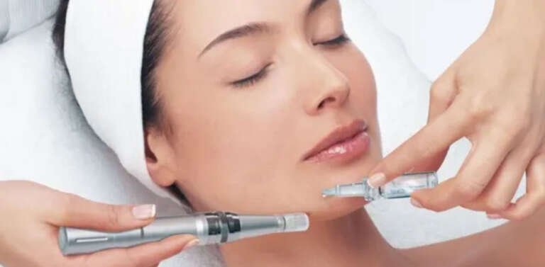 Are at Home Microneedling Treatments Effective?